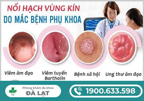 Hình ảnh minh họa